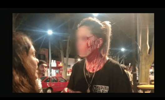 Brutal agresión a una moza con un&nbsp;vaso